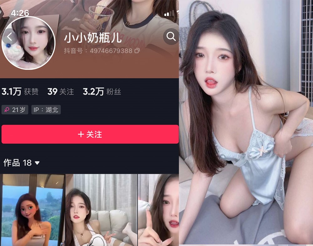 小小奶瓶儿—微密图片视频合集【持续更新】